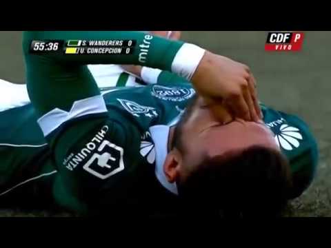 La lesión más rápida de un futbolista // Marco Medel